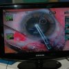 Monitor de Videocirurgia